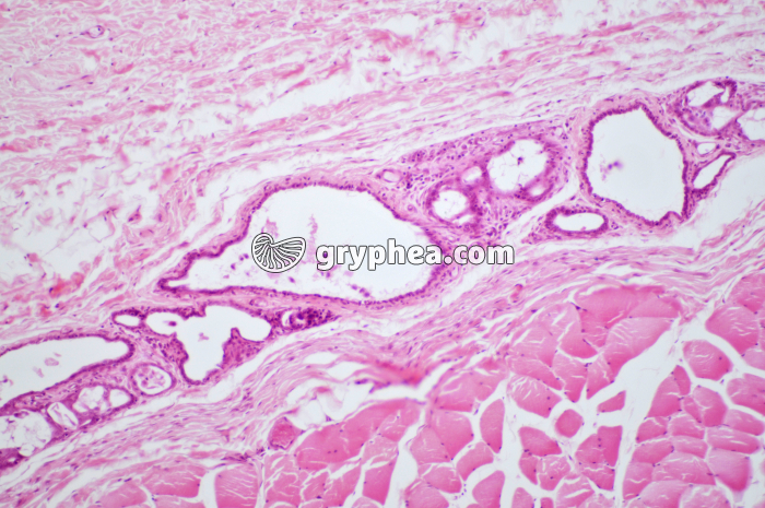 Glande mammaire inactive CT x40 - gryphea.com